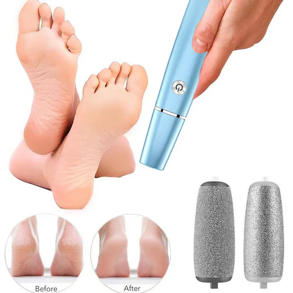 SmoothStep | Elektrische eeltverwijderaar voor de voeten – Oplaadbaar, draagbaar pedicure-apparaat