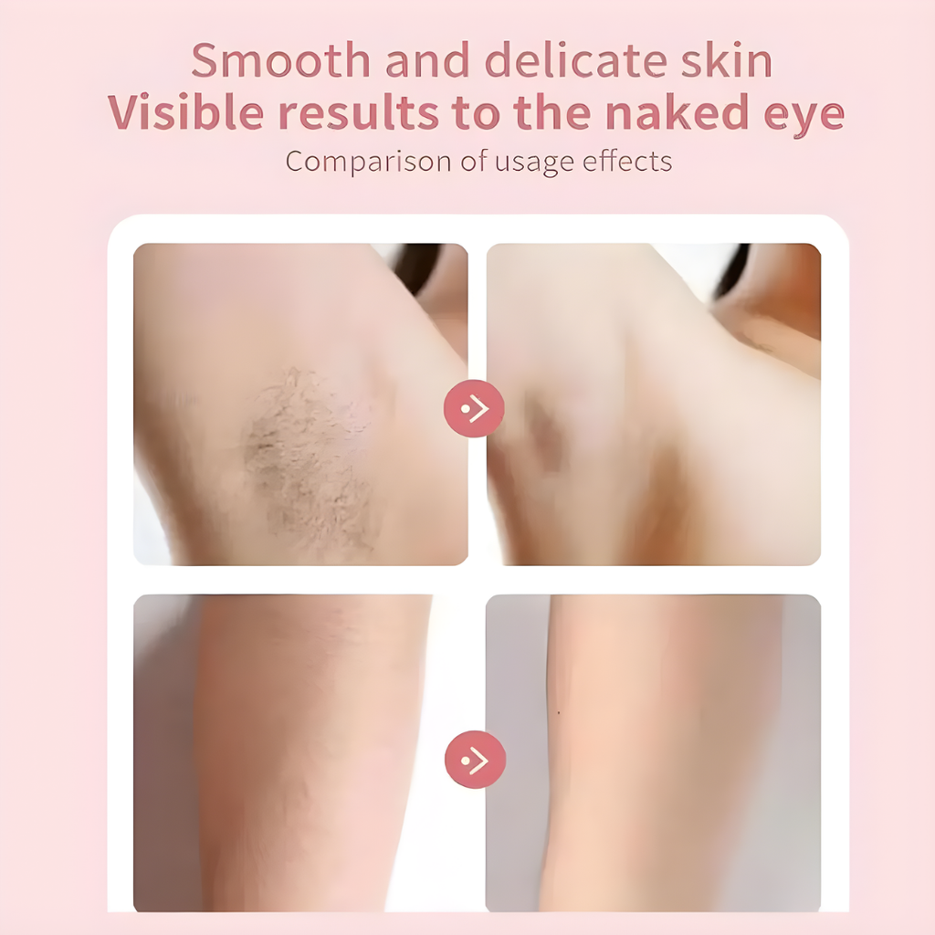 Smoothelle | Oplaadbare epilator – pijnloos elektrisch ontharingsapparaat, draadloze gezichts