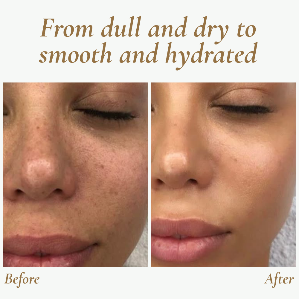 GlowSonic | Professionele draagbare ultrasone gezichtsreinigingsscrubber – Diepe reiniging