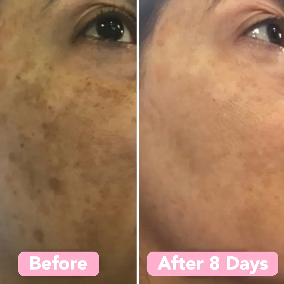 Glowmeric | Kurkuma gezichtsreinigingsspons – Zachte exfoliatie voor de gevoelige, acnegevoelige huid