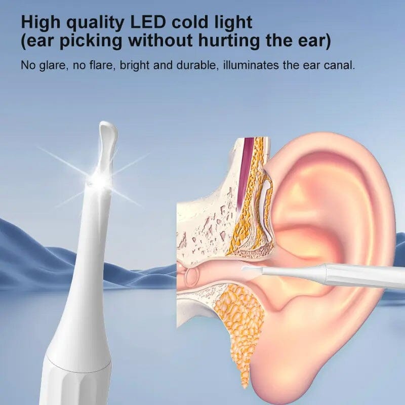 EarScope | HD Camera Oorreiniger – Draadloos WiFi, Oplaadbaar, LED-verlichting Otoscoop