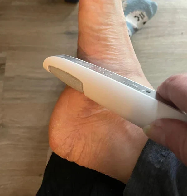 SmoothStep | Elektrische eeltverwijderaar voor de voeten – Oplaadbaar, draagbaar pedicure-apparaat