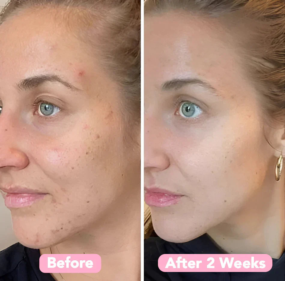 Glowmeric | Kurkuma gezichtsreinigingsspons – Zachte exfoliatie voor de gevoelige, acnegevoelige huid